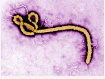 Enlarged image of ebola virus