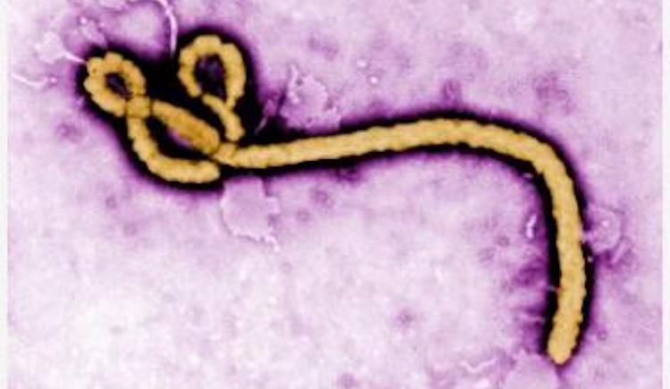 Enlarged image of Ebola virus